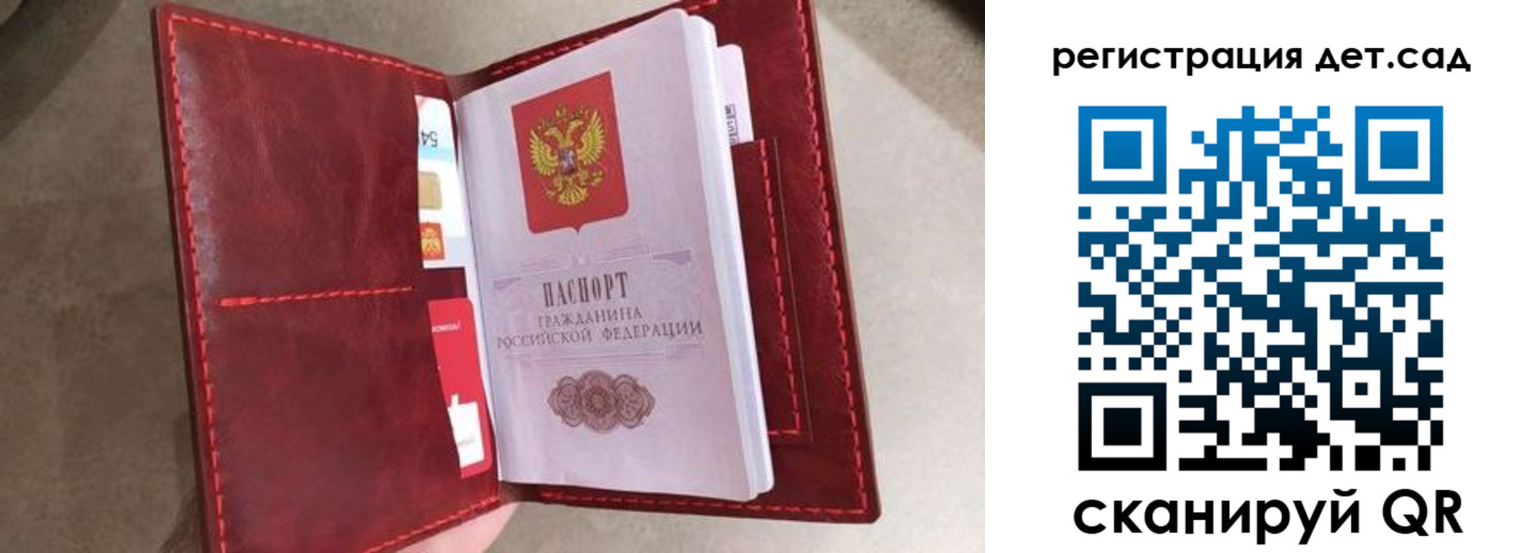 прописка гарантия в Козельске
